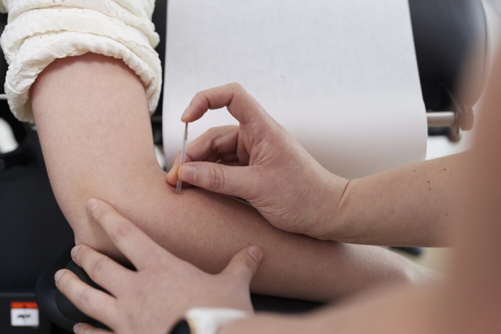 Dry needling van de elleboog in de Spine Clinics-praktijk
