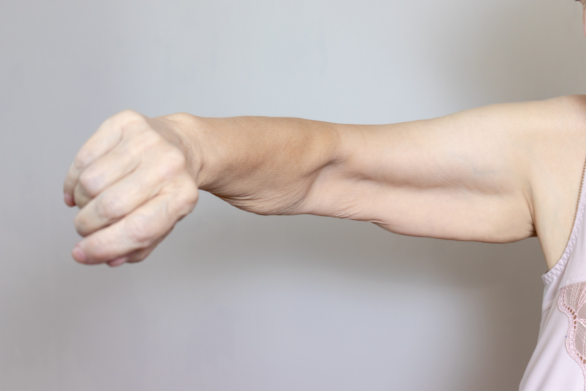 Sarcopenie spierkrachtverlies ouderdom spine clinics