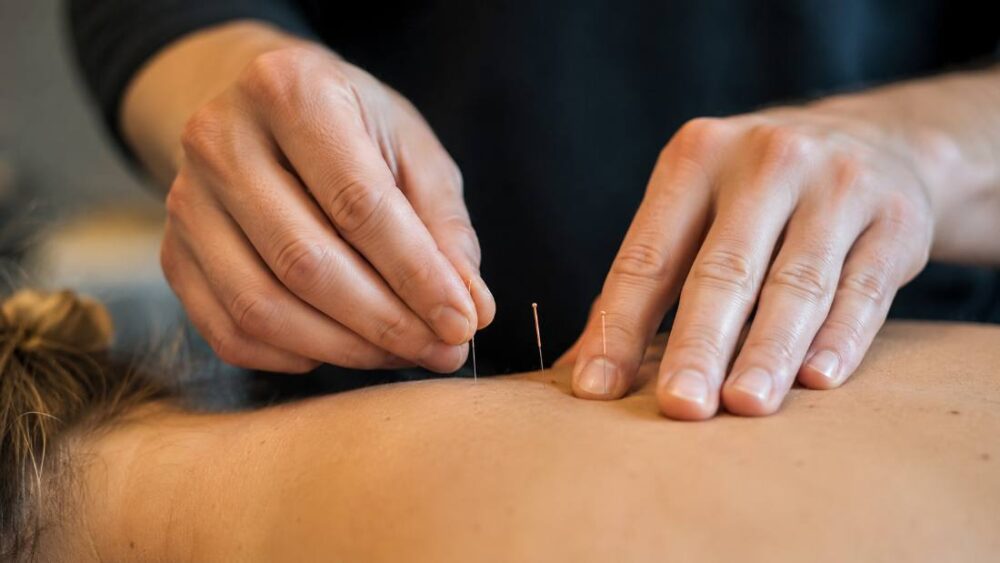 Dry needling-behandeling met dunne naaldjes in een spier
